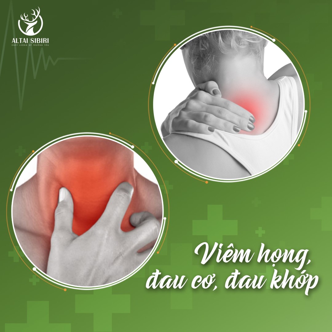 viêm họng